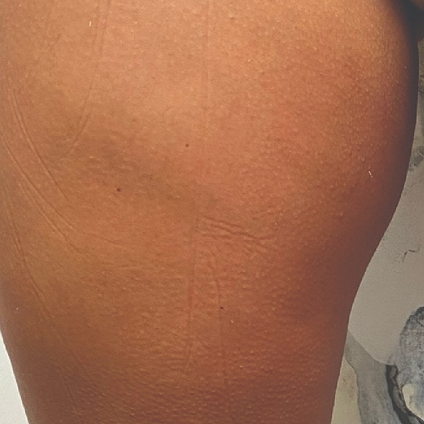 Close-up of skin texture on a leg.