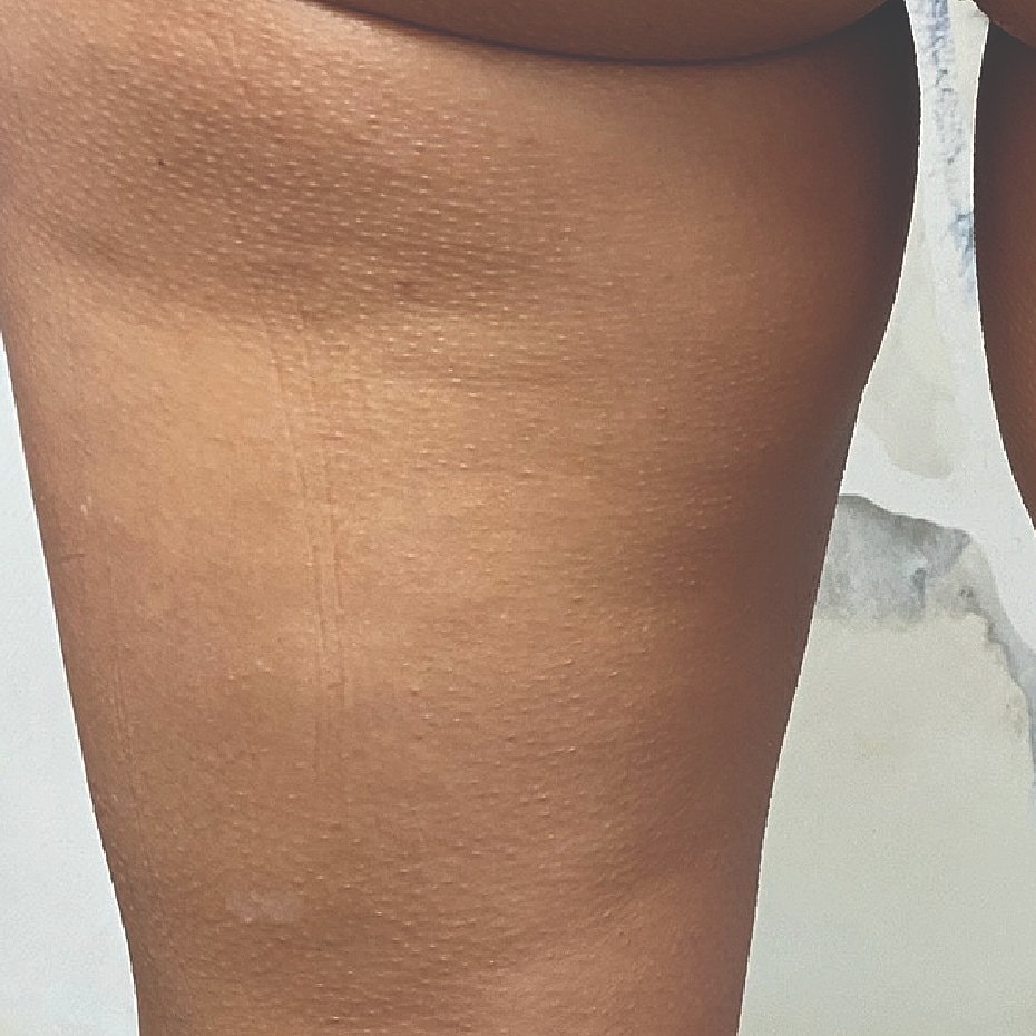 Skin close-up showing texture and features.