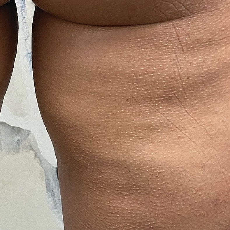 Close-up of skin texture and surface details.