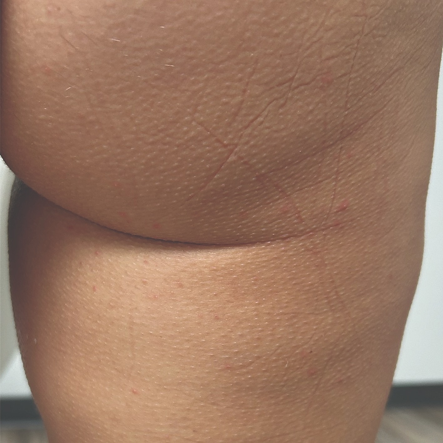 Close-up of skin near the knee.